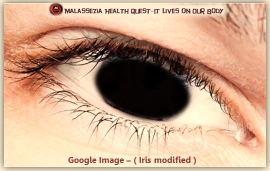 Healthy Eyelashes-MQ